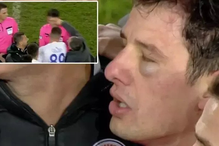 Scandal in Turkiye: "Ankaragucu"- "Rizespor" match referee was beaten - PHOTO - VIDEO