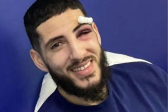 Injury uptade on Yassine Benzia- he will miss the game with Sabah