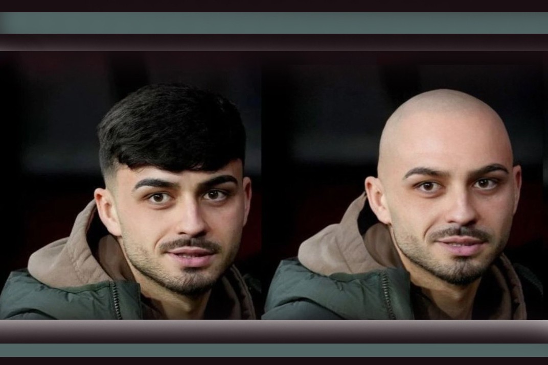 “I've always wanted to see myself bald"