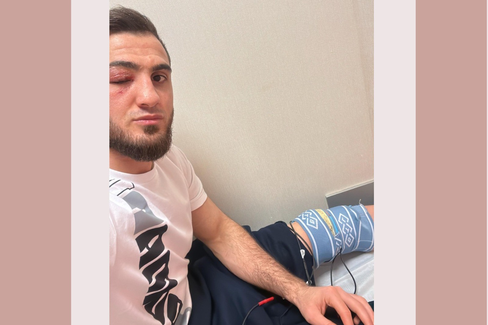 Haji Aliyev: "The problem with both my knees still remains"