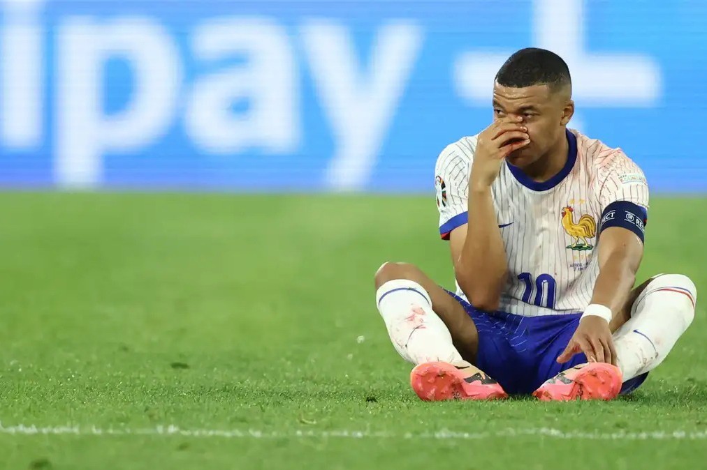 Mbappe breaks nose during match - VIDEO