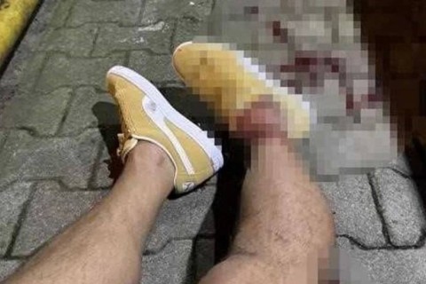 "Fənərbaxça"nın sabiq futbolçusuna silahlı hücum olub - FOTO