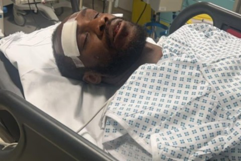 Michail Antonio: “I was close to dying” - PHOTO