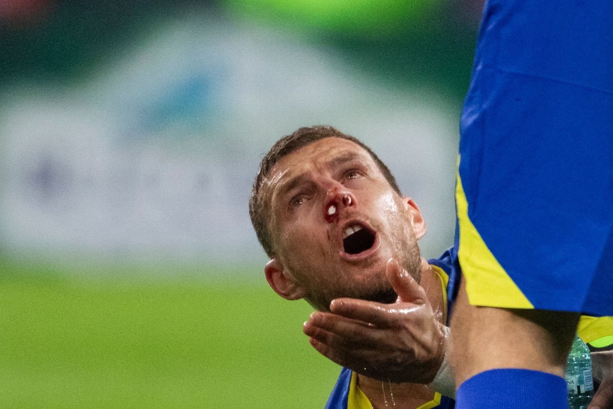 Edin Dzeko: “Ya hər şey, ya heç nə” - FOTO