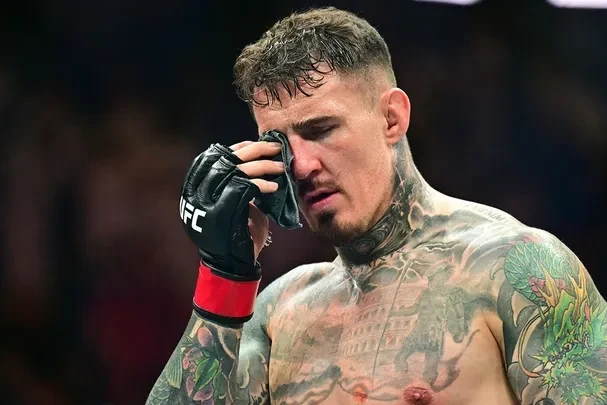 “Hər şey pisdir” - Aspinallın atası Tomun gözü barədə