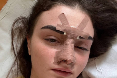 MMA döyüşçüsü həyat yoldaşını döydü - qadın xəstəxanaya çatdırıldı - FOTO