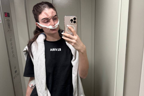 MMA döyüşçüsü həyat yoldaşını döydü - qadın xəstəxanaya çatdırıldı - FOTO