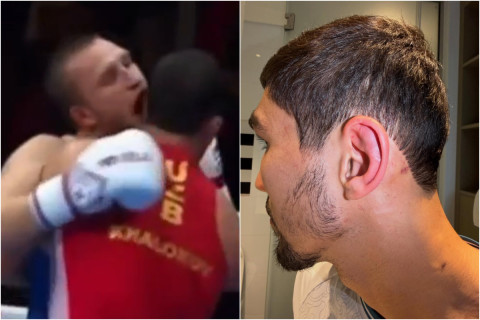 Dünya çempionatının finalında qalmaqal: Rusiyalı boksçu rəqibinin qulağını dişlədi - VİDEO