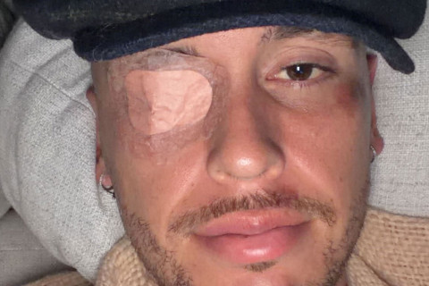 Лукас Окампос получил необычную для футбола травму