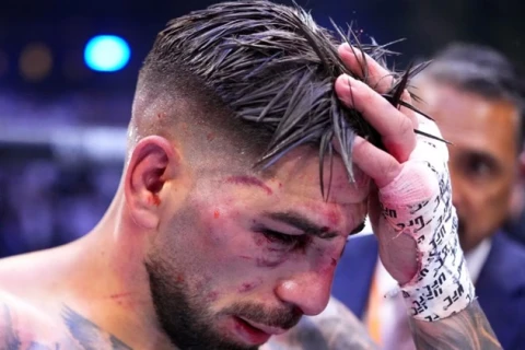 Новые подробности о состоянии Топурии после UFC White House